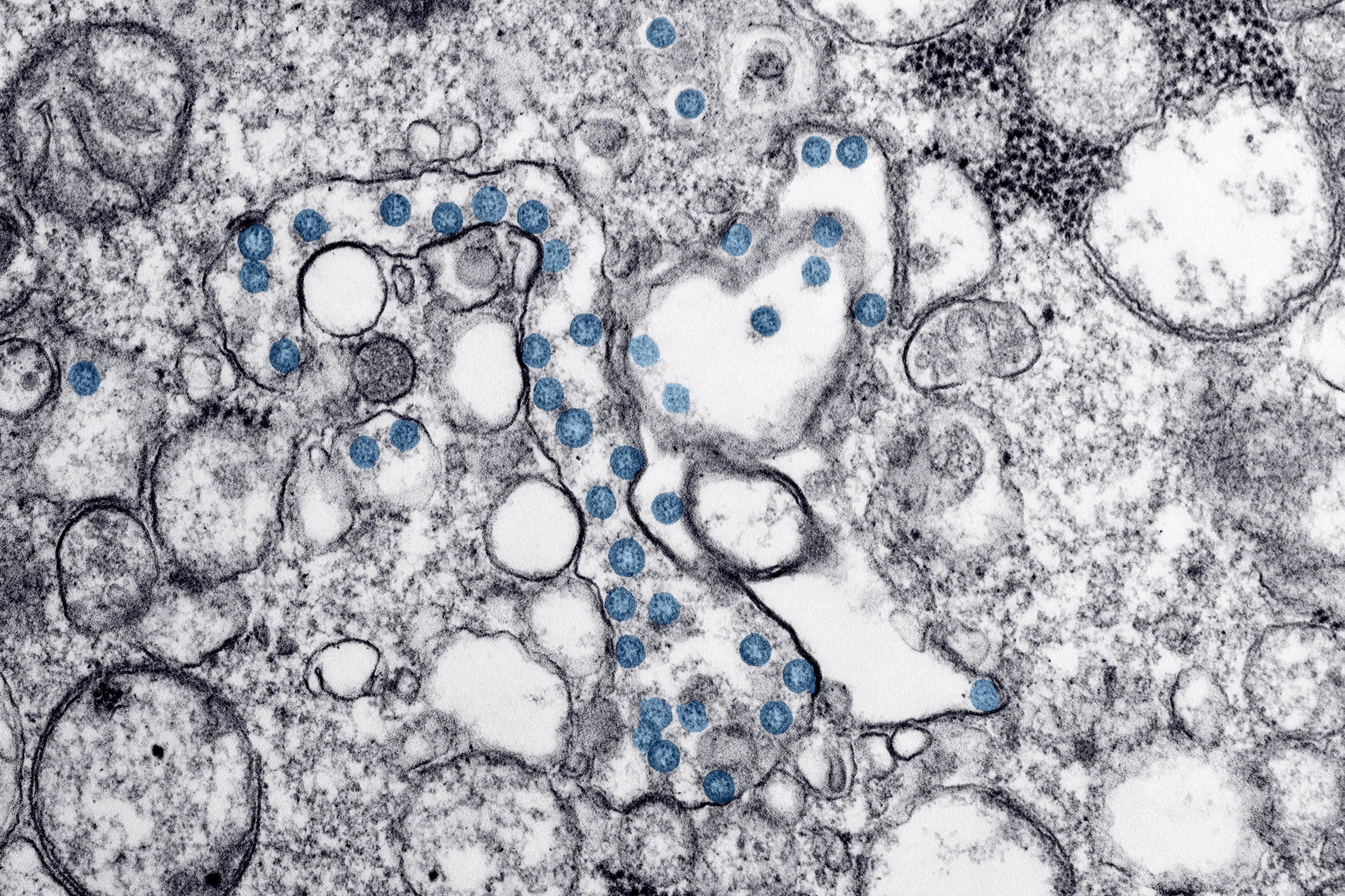 Cells seen through a microscope